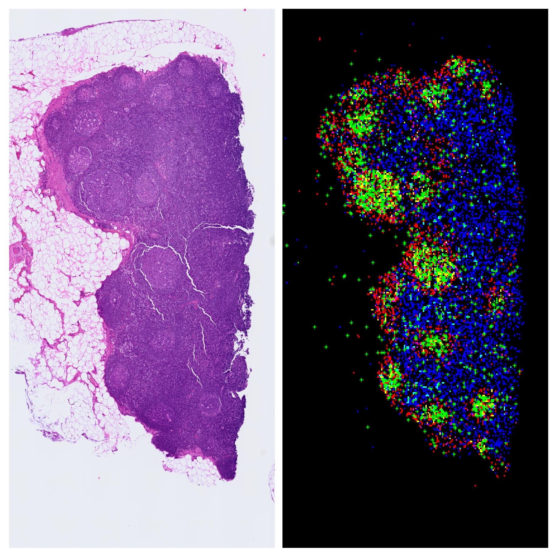 spatial-transcriptomics